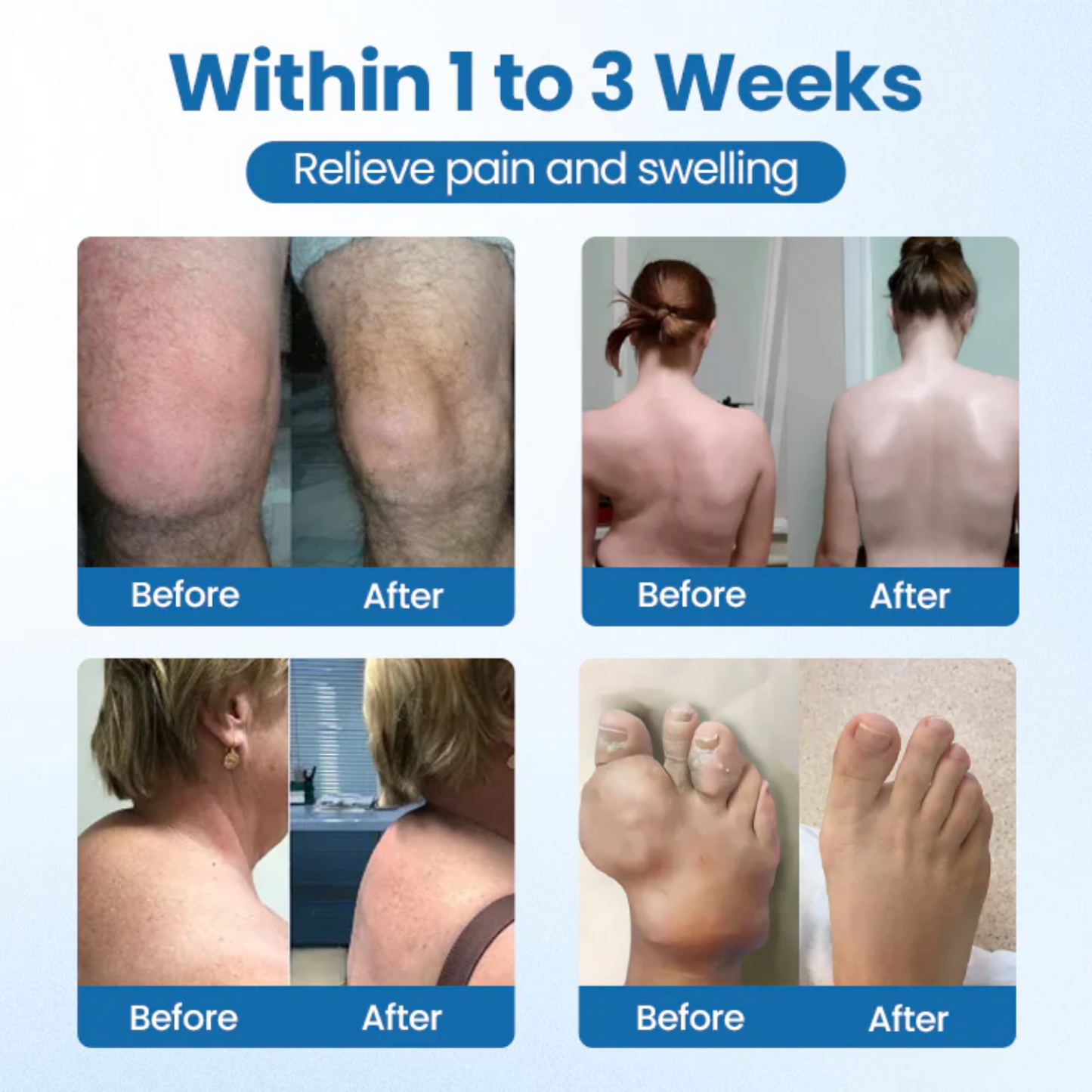 NovaRX® BPC-157 Joint Repair Cream