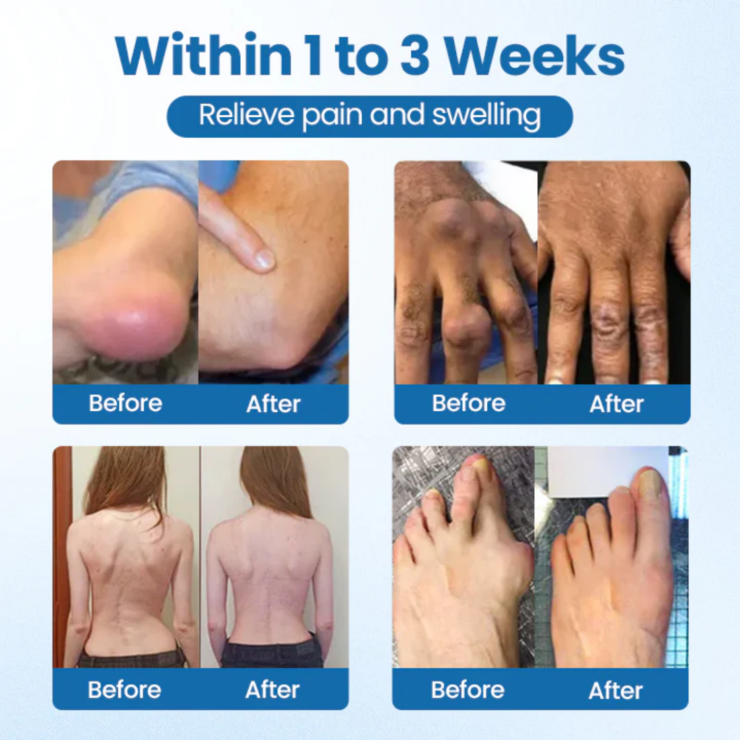 NovaRX® BPC-157 Joint Repair Cream