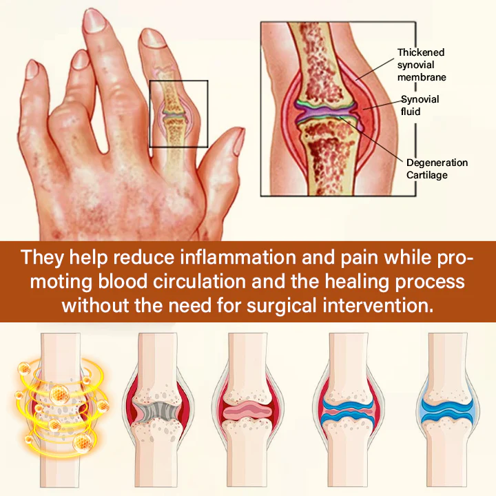 NovaRX® VenomEase Joint Cream