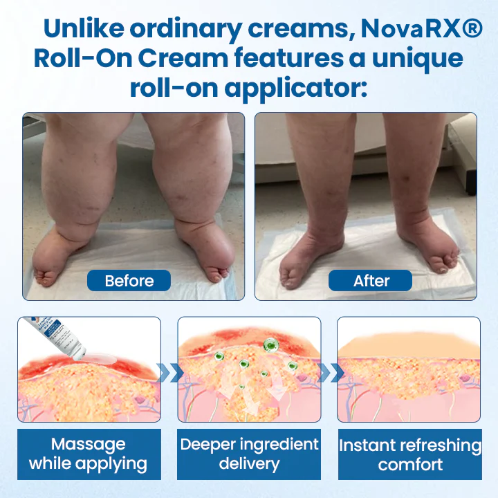 NovaRX® Lymphora Swelling Relief Roll-On
