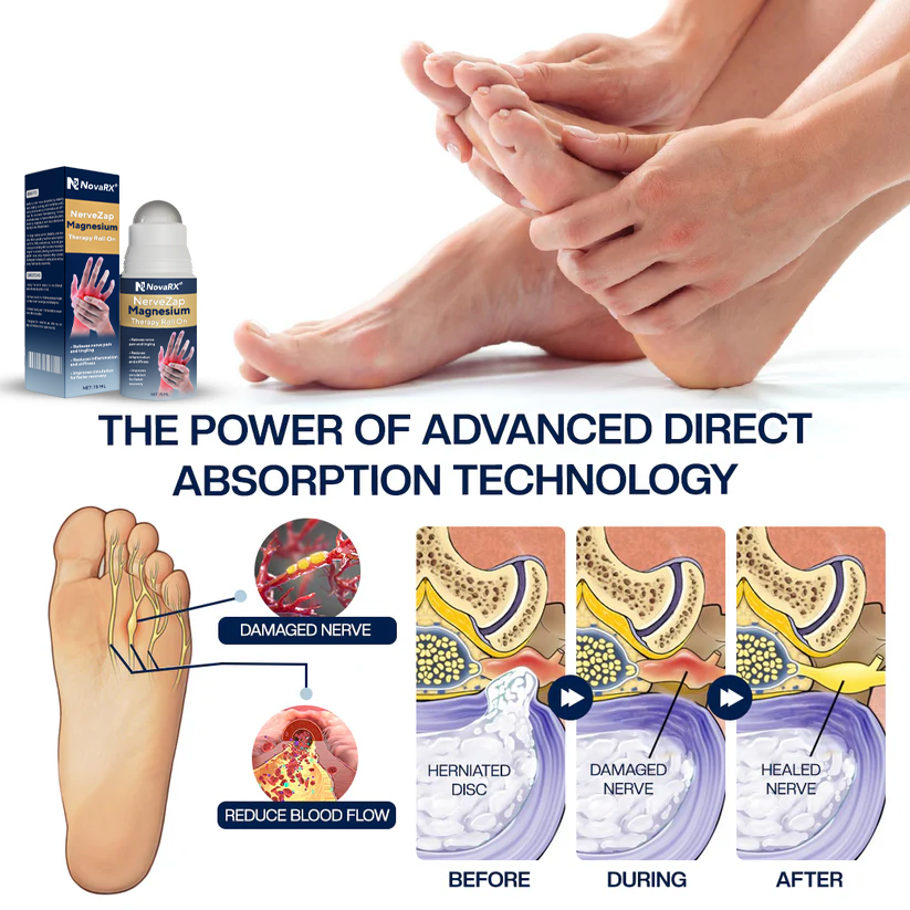 NovaRX® NerveZap Magnesium Therapy Roll On
