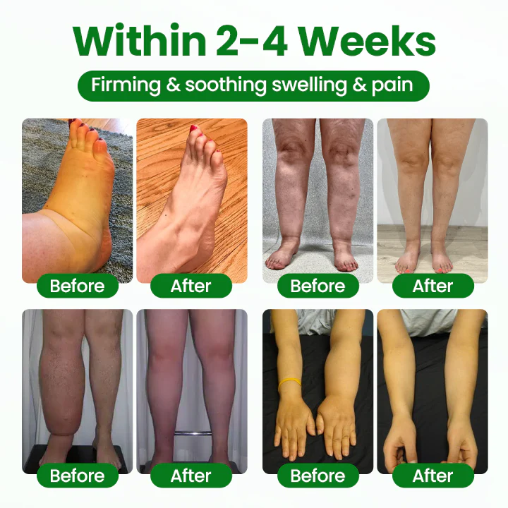 NovaRX® VenoLift Leg Relief Spray