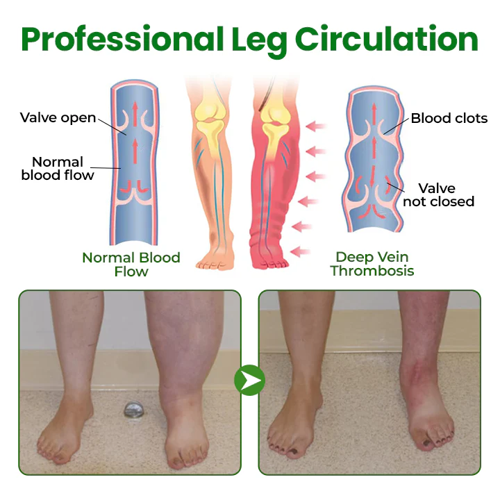 NovaRX® VenoLift Leg Relief Spray