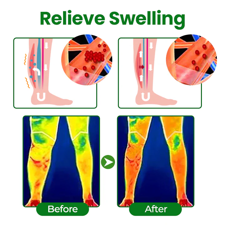 NovaRX® VenoLift Leg Relief Spray