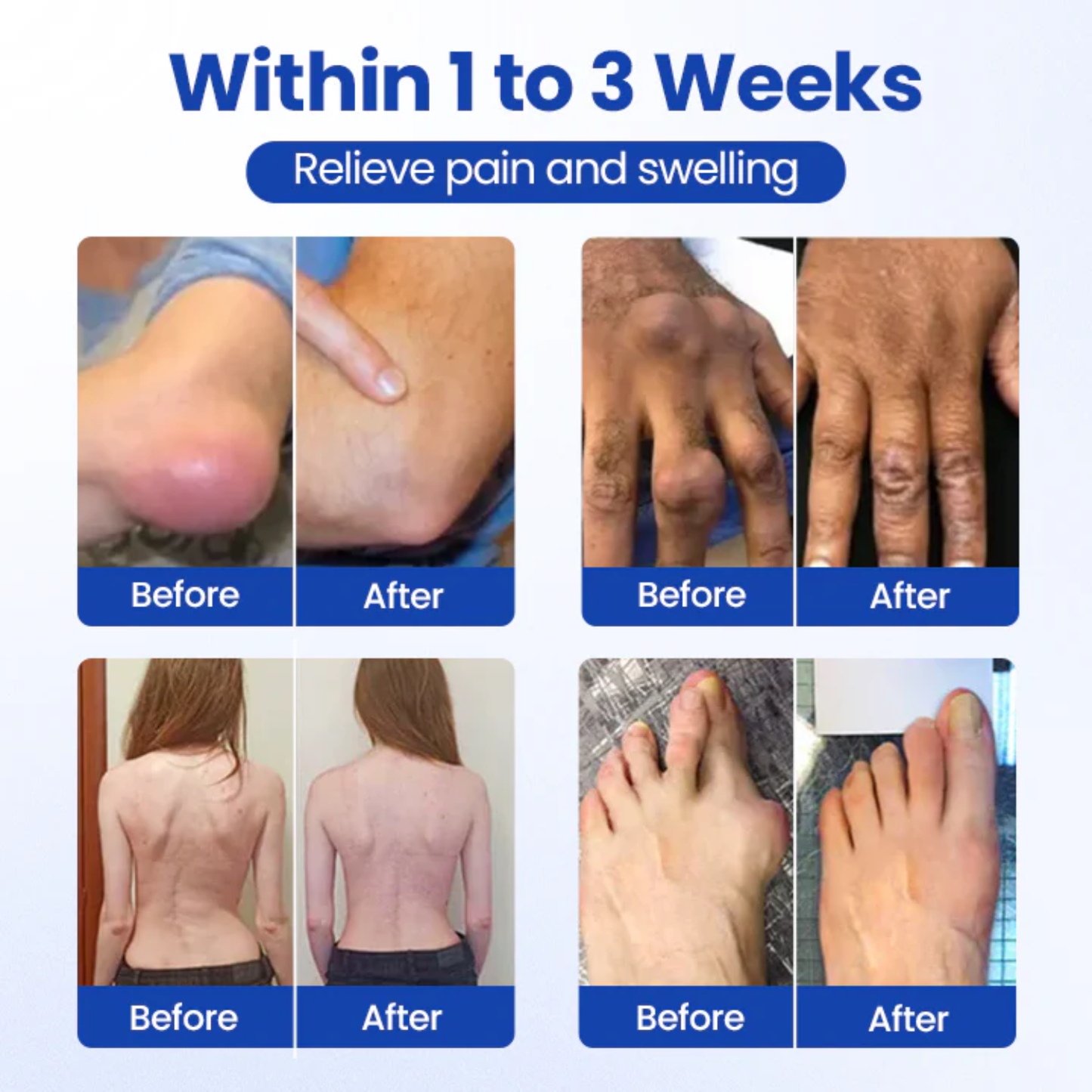 NovaRX® BPC-157 Joint&Bone Repair Roll-On Gel