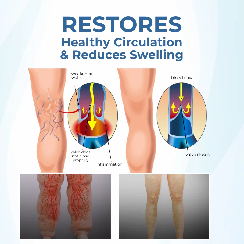 NovaRX® TheraVein Varicose Herbal Spray