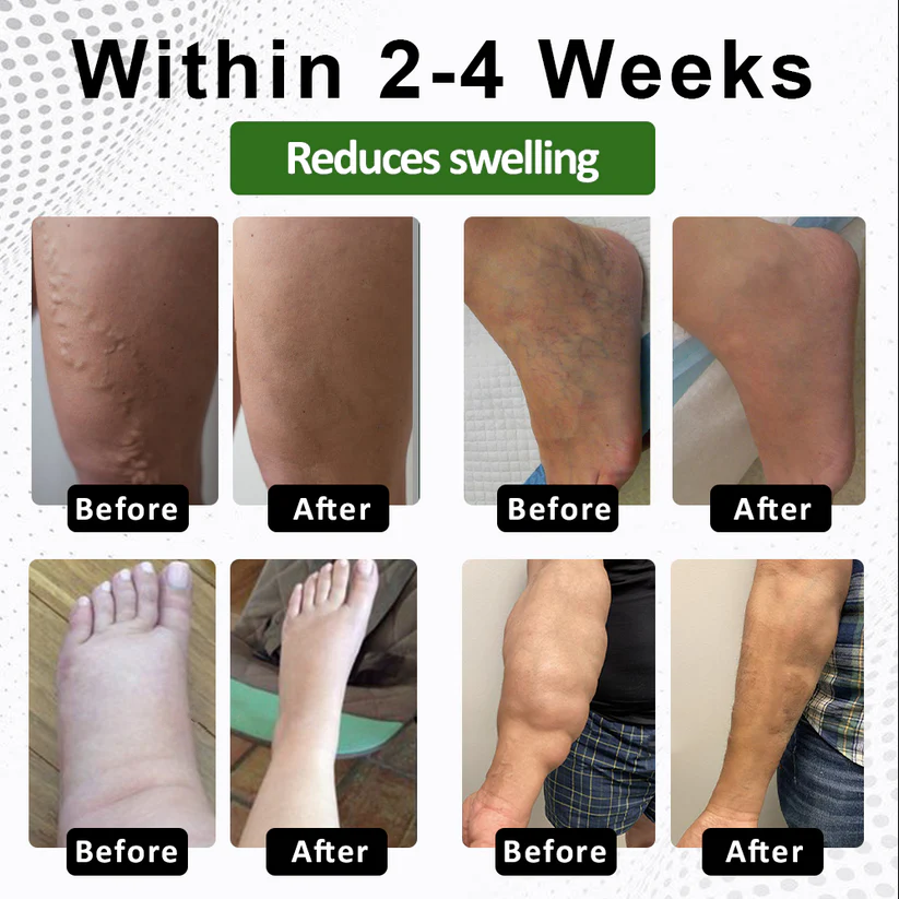 NovaRX® FluidQuit Edema Support Spray