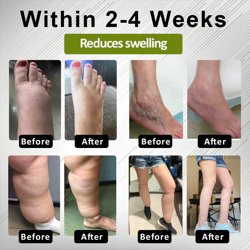 Fivfivgo® EdemaFree Flow Drain Massage Cream