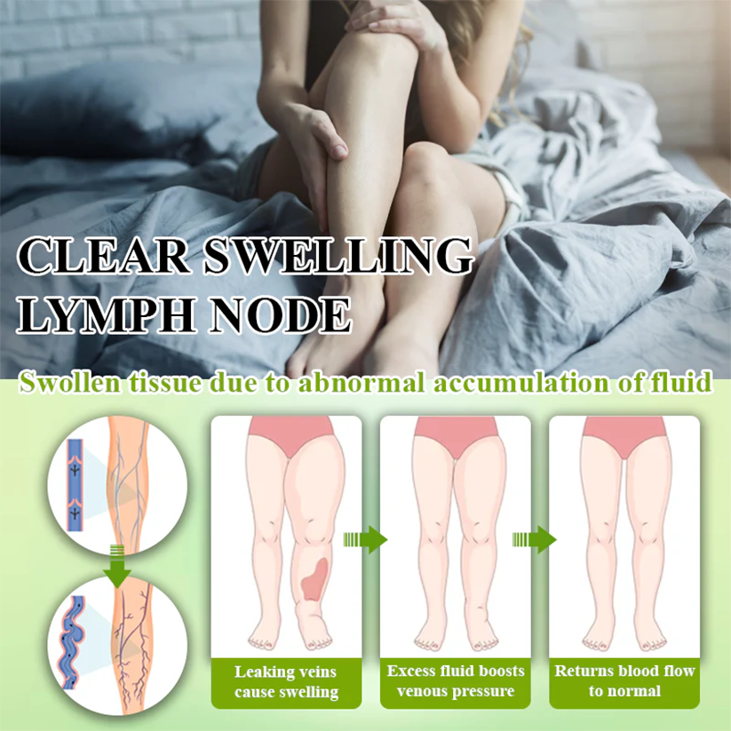 NovaRX® FluidQuit Edema Support Spray