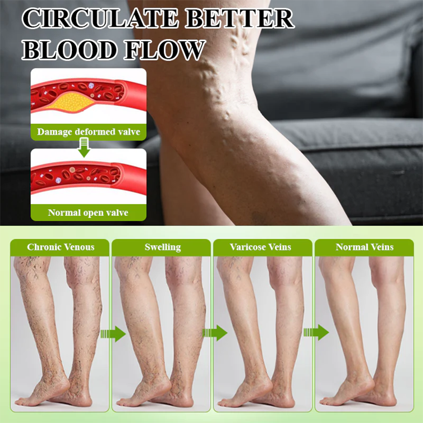 NovaRX® FluidQuit Edema Support Spray