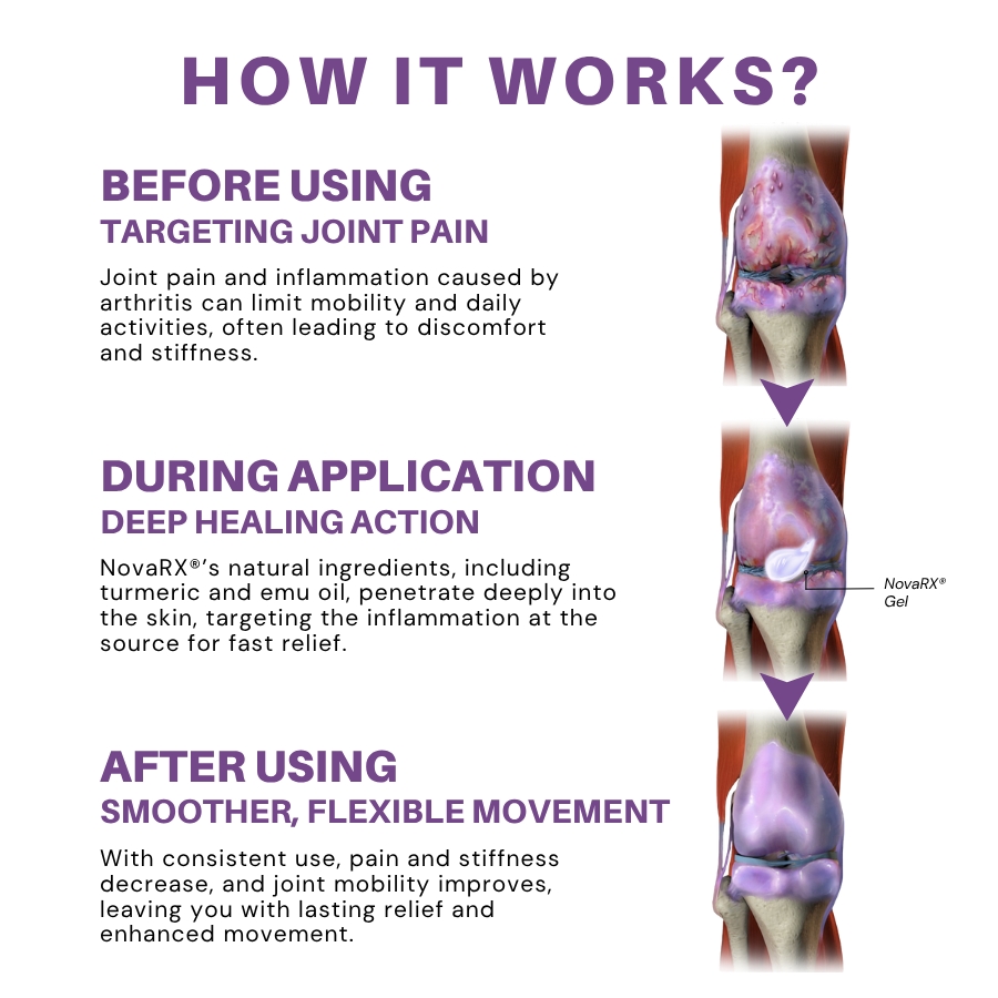 NovaRX® Turmeric & Emu Oil Arthritis Soothing Pain Relief Gel image NovaRX® Turmeric & Emu Oil Arthritis Soothing Pain Relief Gel