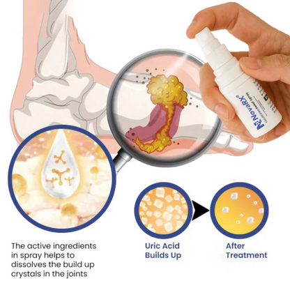 NovaRX® GoutEase Relief Spray