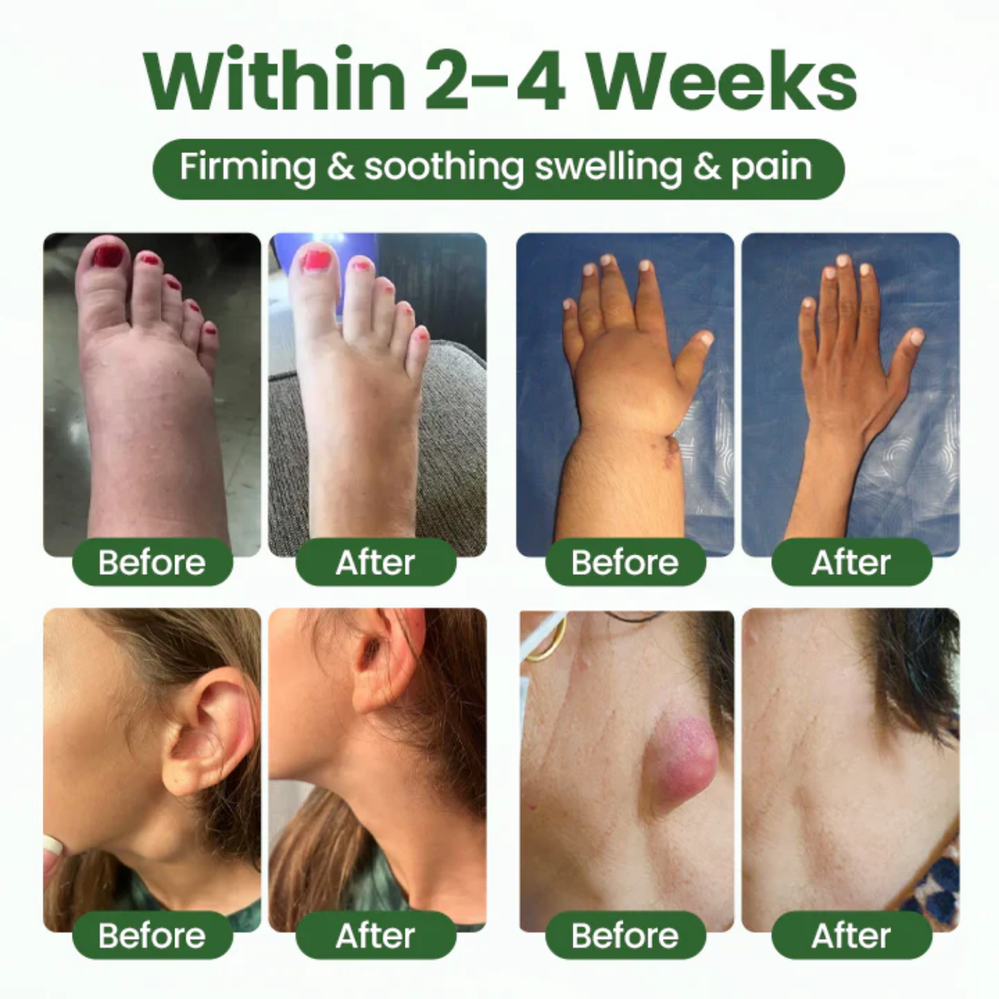 NovaRX® BodyRelief Circulation Cream