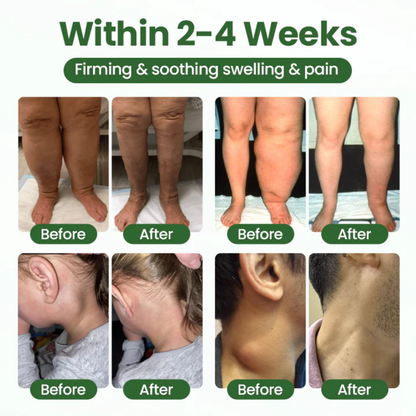 NovaRX® BodyRelief Circulation Cream