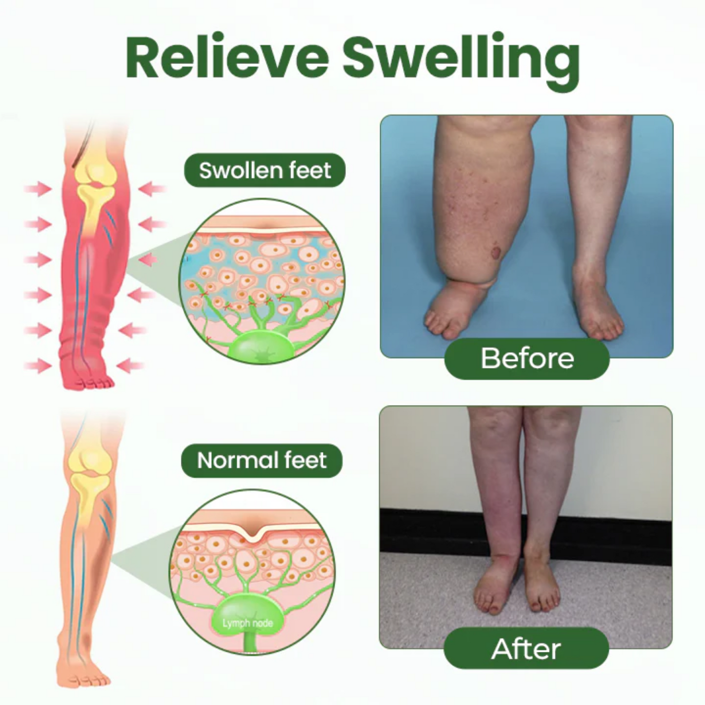 NovaRX® BodyRelief Circulation Cream