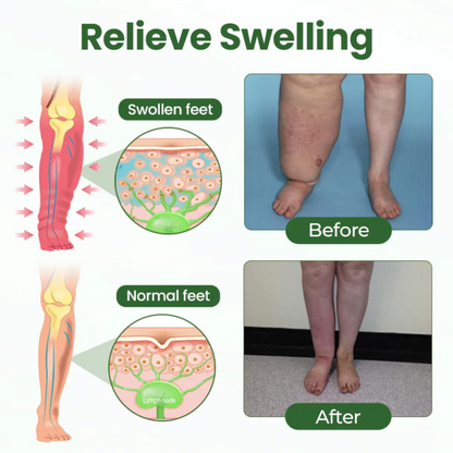 NovaRX® BodyRelief Circulation Cream