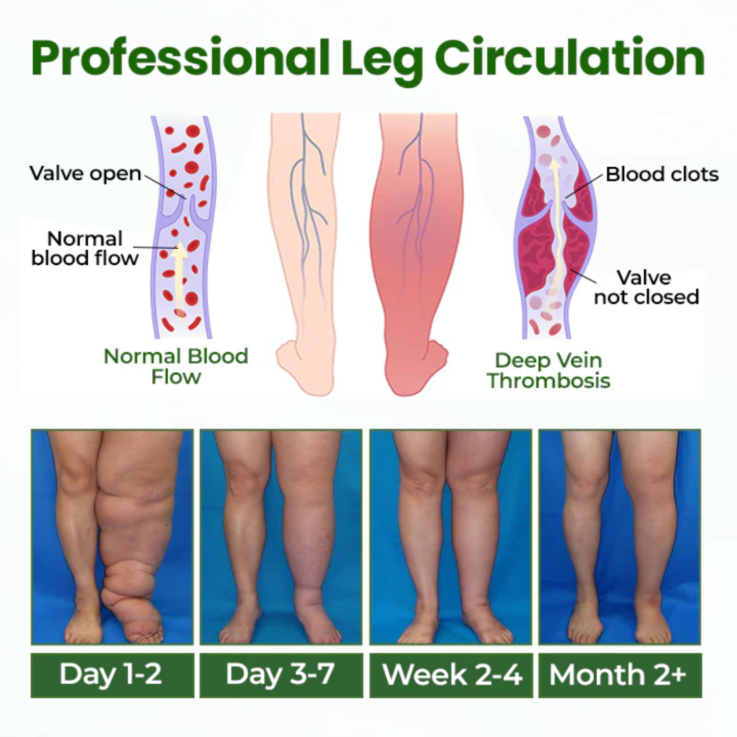 NovaRX® BodyRelief Circulation Cream