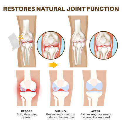NovaRX® Bee Venom Joint Threapy Botanical Patch