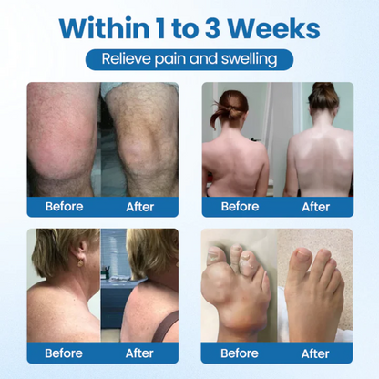 NovaRX® BPC-157 Joint Repair Cream