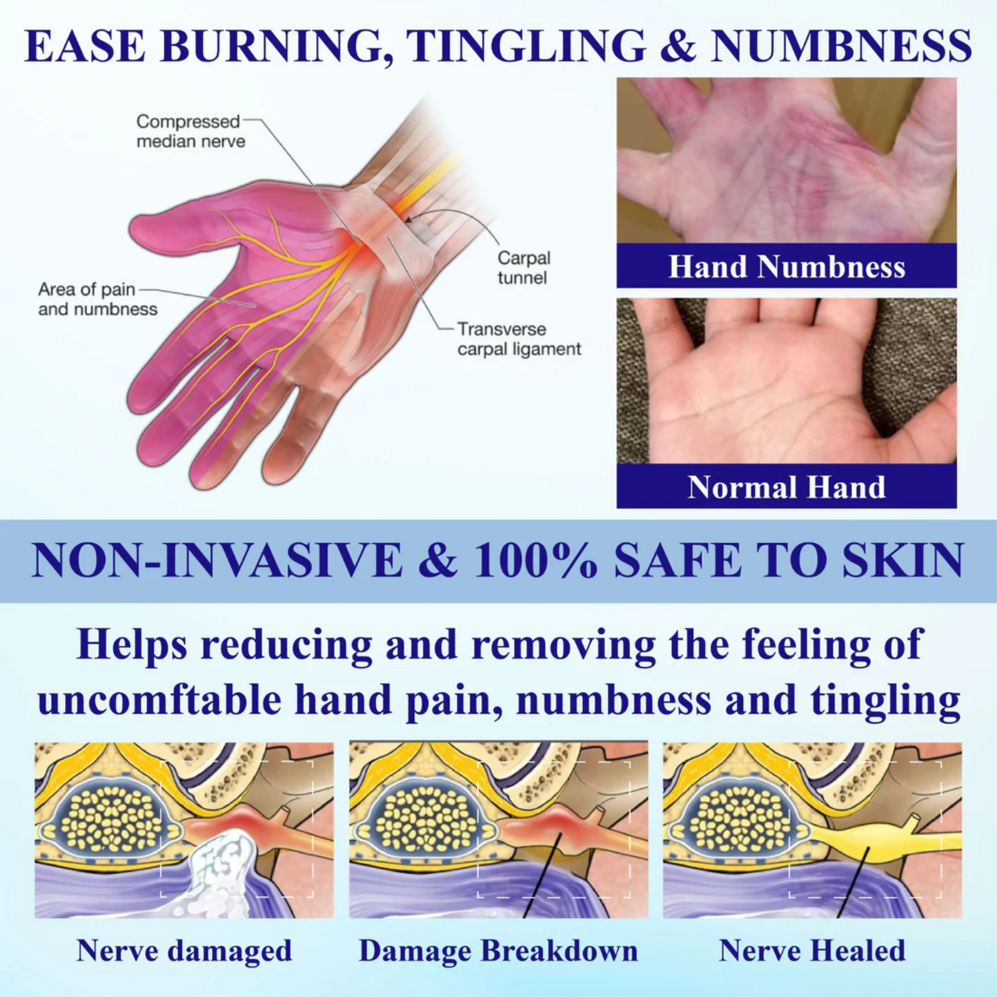 NovaRX® NumbAway CoolEase Neuropathy Spray