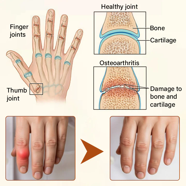 NovaRX® VenomEase Joint Cream