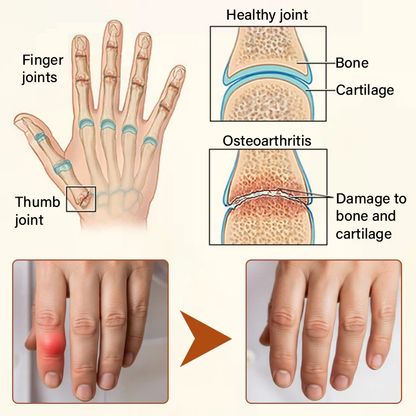 NovaRX® VenomEase Joint Cream