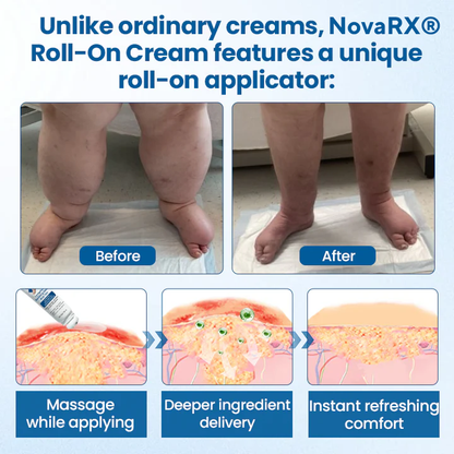 NovaRX® Lymphora Swelling Relief Roll-On