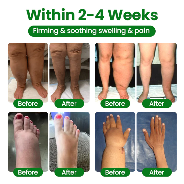 NovaRX® VenoLift Leg Relief Spray