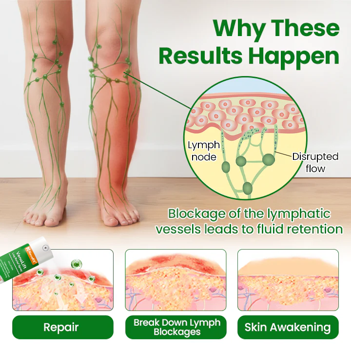 NovaRX® VenoLift Leg Relief Spray