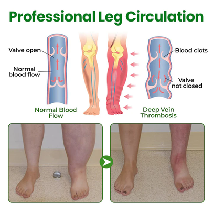 NovaRX® VenoLift Leg Relief Spray