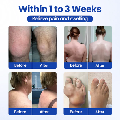 NovaRX® BPC-157 Joint&Bone Repair Roll-On Gel