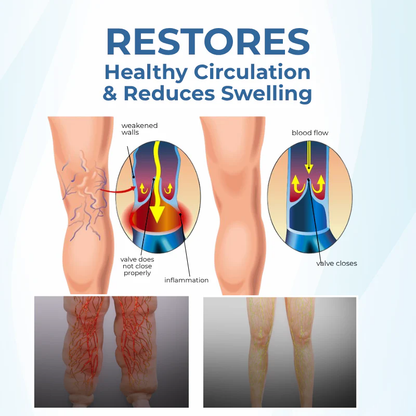 NovaRX® TheraVein Varicose Herbal Spray