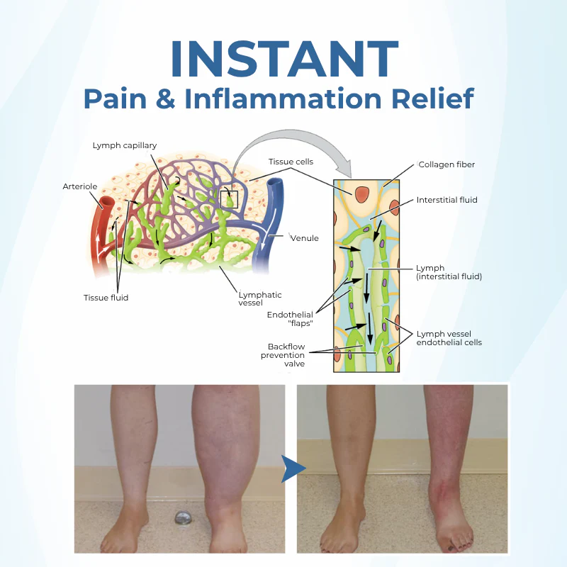 NovaRX® TheraVein Varicose Herbal Spray