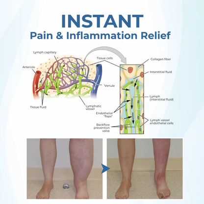 NovaRX® TheraVein Varicose Herbal Spray