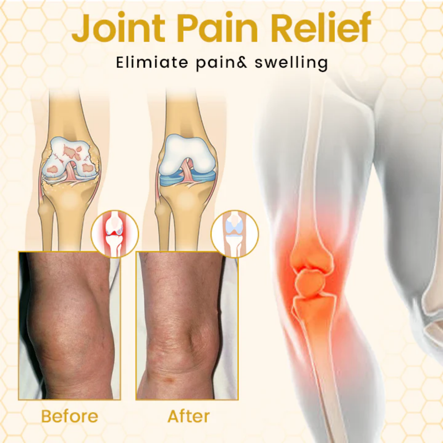 NovaRX® VenomFlex Bee Therapy Cream