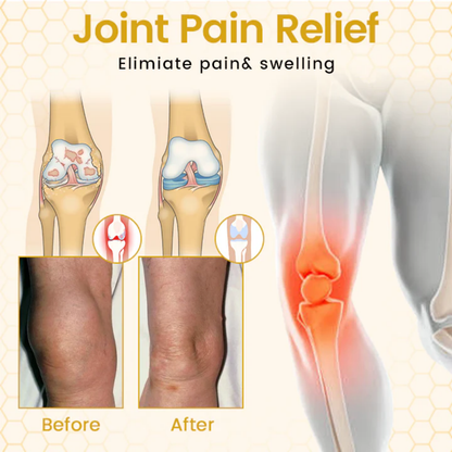 NovaRX® VenomFlex Bee Therapy Cream