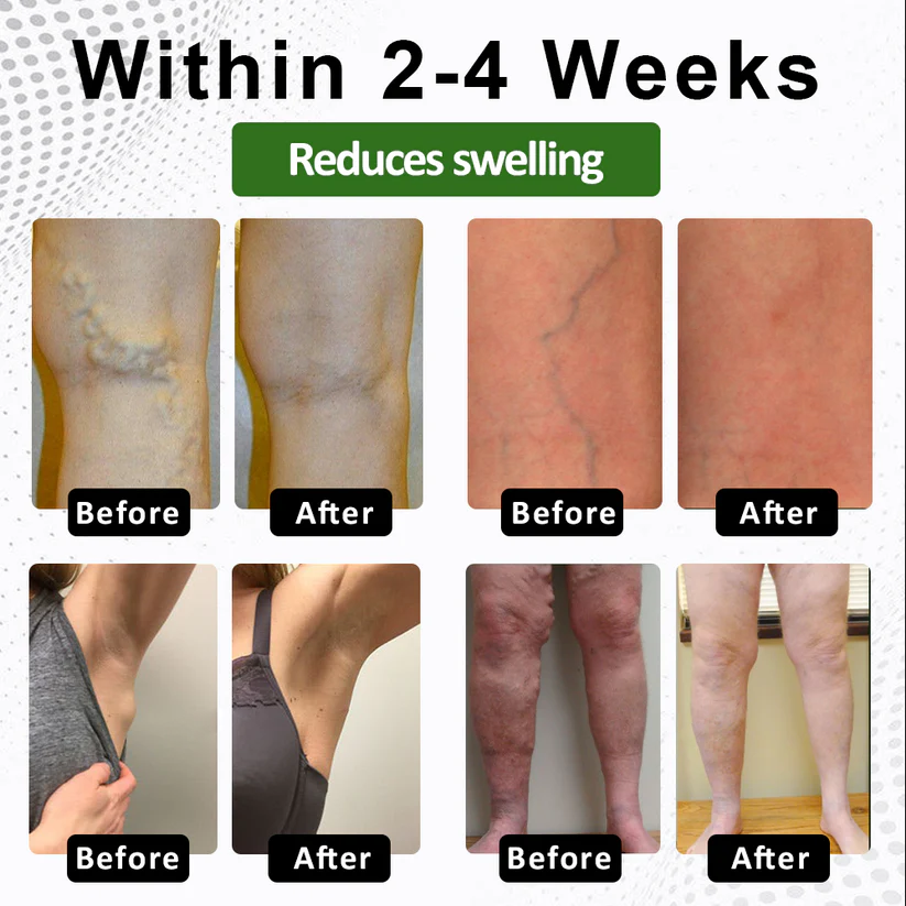 NovaRX® FluidQuit Edema Support Spray