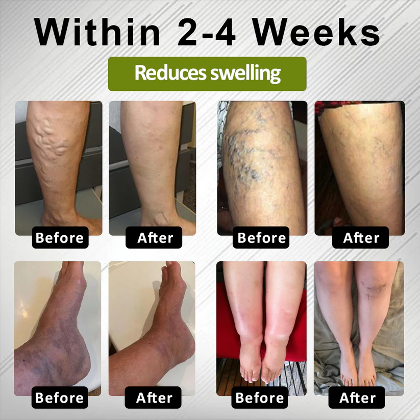 Fivfivgo® EdemaFree Flow Drain Massage Cream