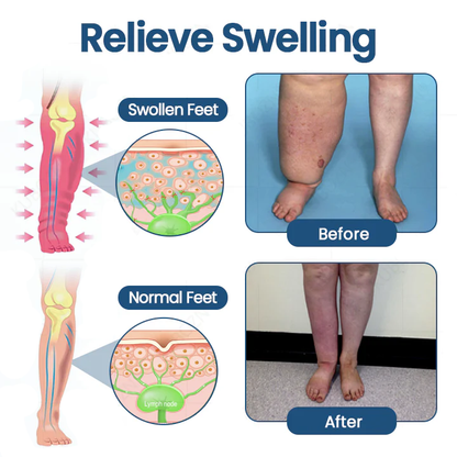 NovaRX® Roll-On Pump Cream for Lymphatic Drainage & Swelling Relief