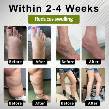 Fivfivgo® EdemaFree Flow Drain Massage Cream