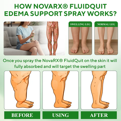 NovaRX® FluidQuit Edema Support Spray