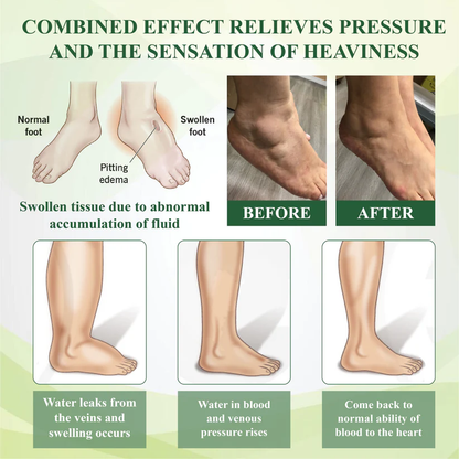 Fivfivgo® EdemaFree Flow Drain Massage Cream