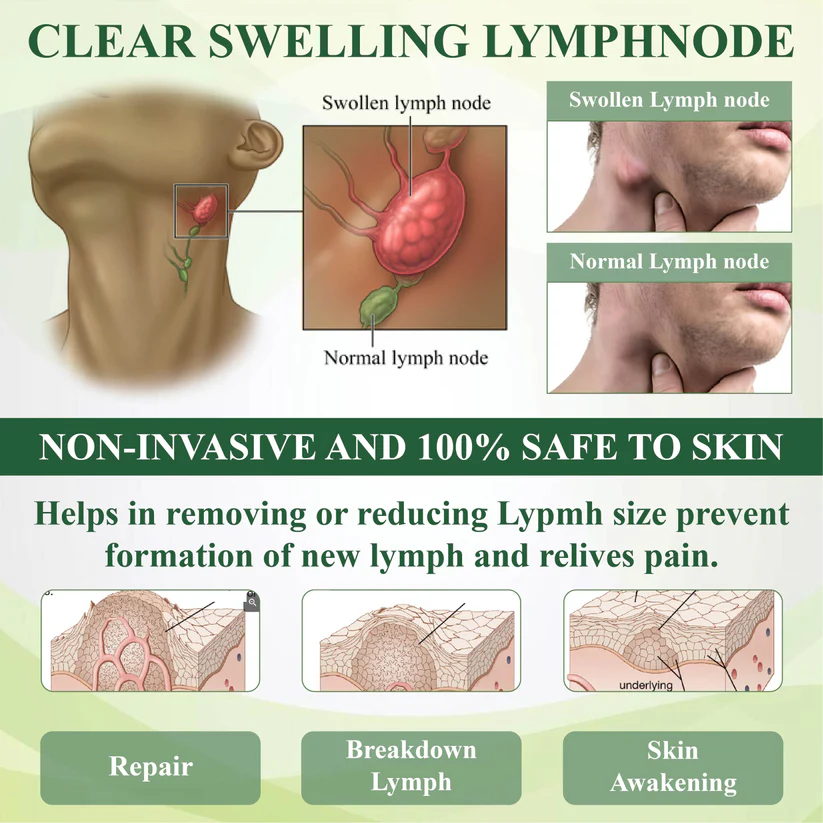 Fivfivgo® EdemaFree Flow Drain Massage Cream