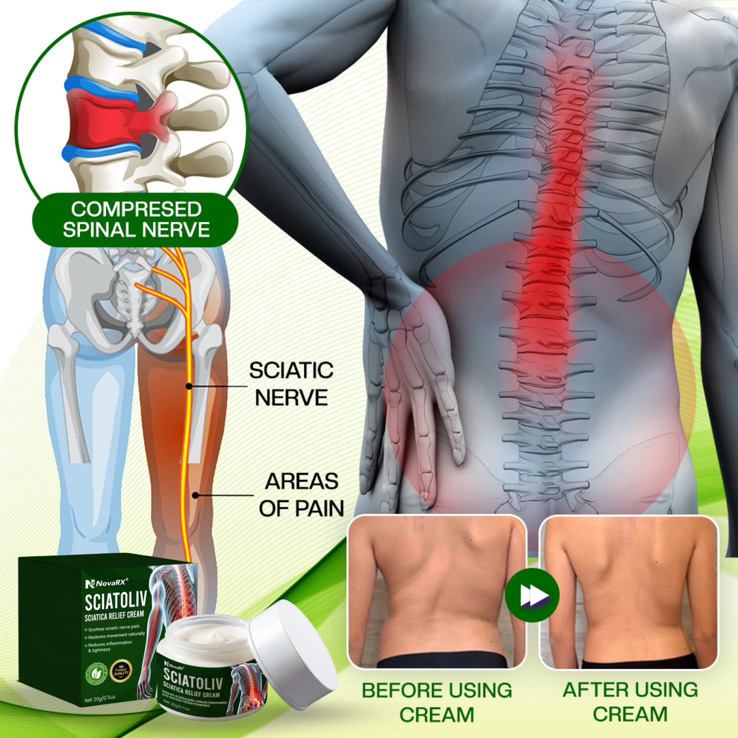 NovaRX® Sciatoliv Sciatica Relief Cream